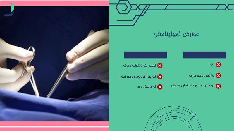 عوارض لابیاپلاستی