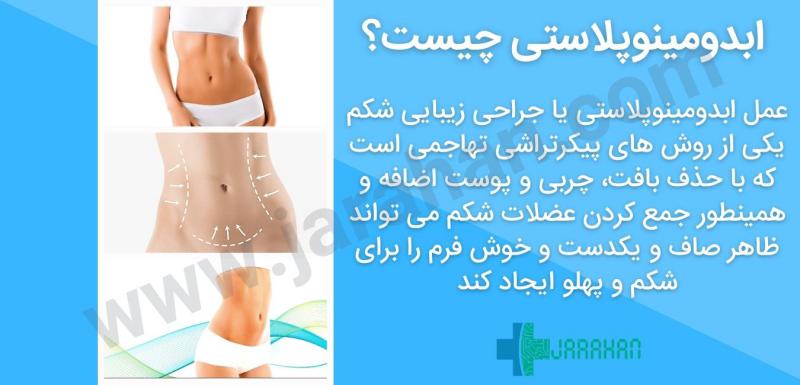 بعد از عمل بالن معده چی بخوریم+ابدو یا ابدومینوپلاستی چه عملی است+لیپوساکشن چگونه است+آیا عمل لیپوماتیک بیهوشی دارد