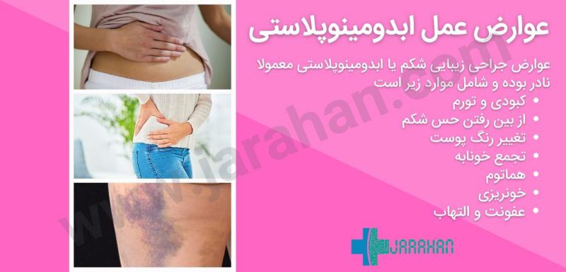بعد از عمل بالن معده چی بخوریم+ابدو یا ابدومینوپلاستی چه عملی است+لیپوساکشن چگونه است+آیا عمل لیپوماتیک بیهوشی دارد