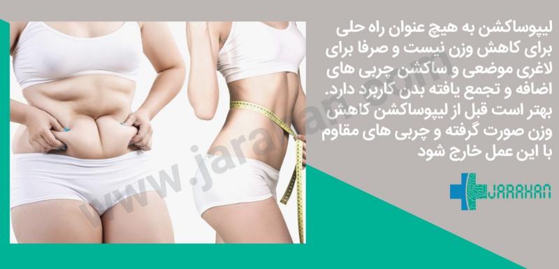 هزینه ساکشن /لیپوساکشن شکم و پهلو در تهران